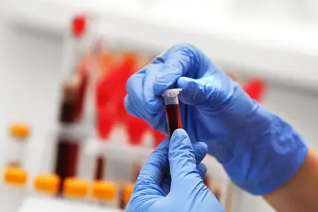 BABIO ने फ्लोरोसेन्स बोवाइन प्रेग्नन्सी रॅपिड टेस्ट लाँच केली