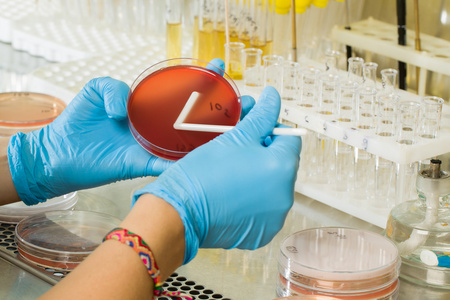 BABIO चे MacConkey Agar माध्यम - ग्लोबल मायक्रोबायोलॉजिकल डायग्नोस्टिक्ससाठी प्रीमियम निवडक अलगाव